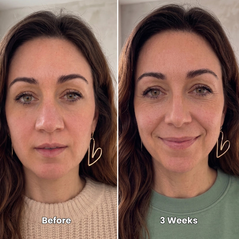 Before and after results after 3 weeks
